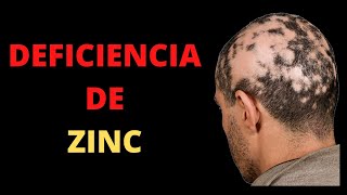 8 Datos de DEFICIENCIA DE ZINC que nunca debes de ignorar Zinc bajo [upl. by Aelahs]