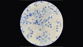 Sputum Test AFB StainingMLT PRACTICAL [upl. by Carce]