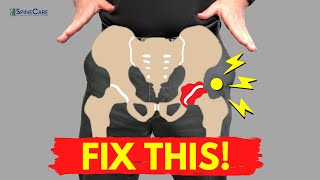 How to Fix a Popping Hip for Good NO EQUIPMENT [upl. by Tanhya77]