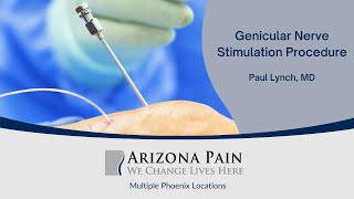 Watch A Genicular Nerve Stimulation Procedure  Arizona Pain [upl. by Spindell128]