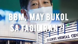 BBM may bukol sa tagiliran Colostomy bag saraduterte bbm ofw prrd [upl. by Huey]