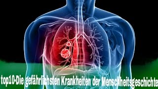 top10 Die gefährlichsten Krankheiten der Menschheitsgeschichte [upl. by Nitsirc426]