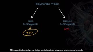 Differentiating between Ventricular Tachycardia VTach and Torsades de Pointes  Good Reads Ep 6 [upl. by Nevin]