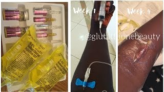 Glutathione Injection Whitening for black skin [upl. by Aneres]