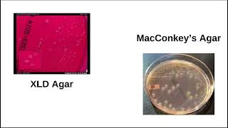 12 Detection and Confirmation of Shigella [upl. by Consalve]