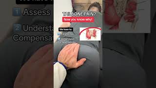 💥Suffering from Tailbone Pain💥 👉 We have to remember that when we have back pain that the tailbone [upl. by Natfa]