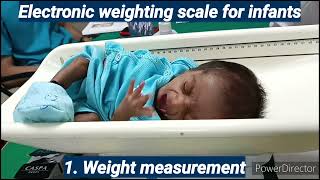 Assessment of Physical Growth by Anthropometric Measurements  Competency PE 14  Pediatrics [upl. by Erb]