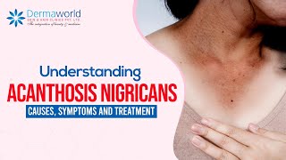 Understanding Acanthosis Nigricans Causes Symptoms and Treatment [upl. by Jestude]