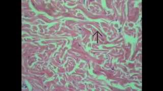 Histology of Connective Tissue [upl. by Rains]