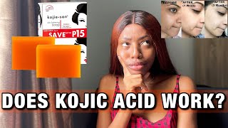 Watch this before you use KOJIC ACID  Kojie San soap for hyperpigmentation and dark spots [upl. by Hcib]