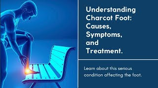 Charcot Foot Explained [upl. by Nelia695]