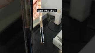 ESR Erythrocyte Sedimentation rate 🩸🩸🧑‍🔬💉blood infectionTest normal valueamp result status shorts [upl. by Campney]