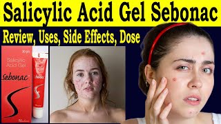 Salicylic Acid Gel Sebonac  Salicylic Acid Gel Review  uses Side Effects Dose How to use [upl. by Ylrebmi407]