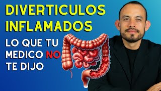 📛 DIVERTICULITIS Síntomas Diagnostico y Tratamiento 2024 [upl. by Sahpec]