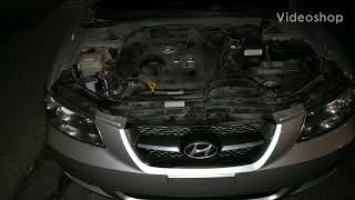 Hyundai Sonata checking fluid levels 2008 [upl. by Naeruat]