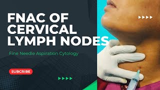 FNAC of Cervical Lymph Nodes।। [upl. by Orofselet]