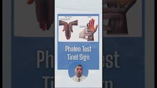 Phalen Test and Tinels Sign [upl. by Corwin]