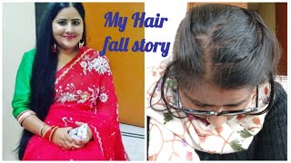 My hair loss storyTelogen effluviumExcess Hair fallHair careHair fall treatment [upl. by Orose]