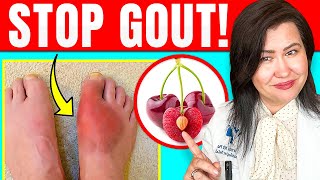 Do These 3 Things To Ease Gout at Home [upl. by Imit354]