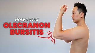 How to do exercises for Olecranon Bursitis  One cause of elbow pain in the triceps region [upl. by Nave]