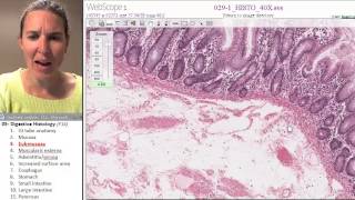 Digestive histology 3 Submucosa [upl. by Lemuela]