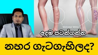 varicose veins amp Spider veins By Nutritionist Hiroshan Jayaranga [upl. by Phaidra]