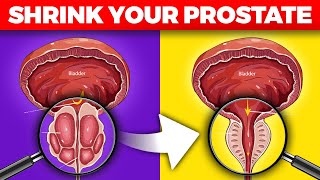 How to Shrink Your Prostate Naturally The 1 Nutrient You Need [upl. by Odnam]