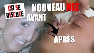 Chirurgie esthétique  elle pleure en voyant son nouveau nez   Ça se discute [upl. by Nani]