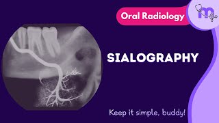 Sialography  Full Video  Oral Radiology  Medi Study Go [upl. by Ainoet]