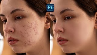 Skin Retouching in Photoshop  Tutorial For Beginners [upl. by Folberth]