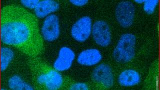 Mitotic catastrophe triggered in human cancer cells by the viral protein apoptin  movie A [upl. by Dene]