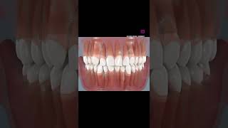 Deciduous vs permanent tooth dentistry dentalprocedure dentaltreatment [upl. by Abagail418]