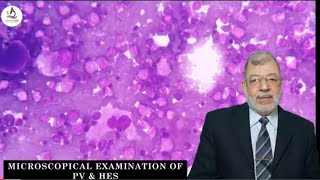 7 Microscopical Exam of PVampHES Cases [upl. by Ruthven]