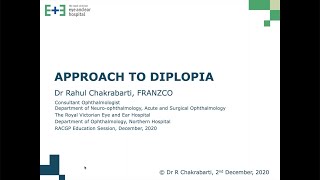 Approach to diplopia webinar held on 2 December 2020 [upl. by Finegan]