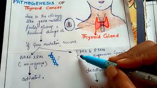 pathogenesis of thyroid cancer NGMedicals [upl. by Gombach]