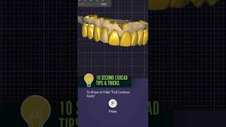 10 second exocad tip press “F” to quick hideshow jaw scans dentalcad smiledesign [upl. by Enyleuqcaj845]