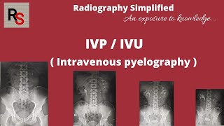 IVP ll Intravenous pyelography ll Intravenous urography ll Radiography simplified ll [upl. by Pelagia]