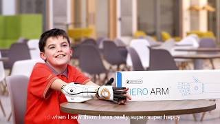 Cameron Receives Star Wars BB8 Bionic Arm Covers [upl. by Ilan]