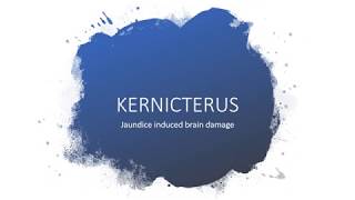 kernicterus brain damage by jaundice [upl. by Bobette338]