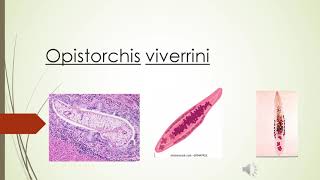 Clonorchis sinensis y opistorchis viverrini [upl. by Blackwell]