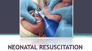 NEONATAL RESUSCITATION PEDIATRICS BSc NURSING GNM medical nursing physiology pediatrics [upl. by Bez493]