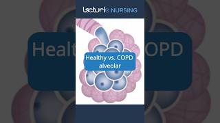 Healthy vs COPD Lungs 🫁 LungHealth COPDAwareness nclexrn [upl. by Milewski]