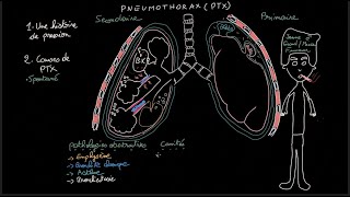 Pneumothorax  Docteur Synapse [upl. by Vardon]