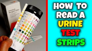 How to read Urine test strips  Health Educare [upl. by Torosian174]