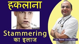 How to stop Stammering  हकलाने का इलाज  Best Treatment of Stammering [upl. by Razaele]