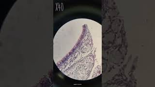 Nasal septum amp respiratory epithelium slide [upl. by Lyontine]