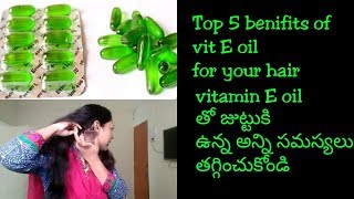 How to use vitamin E oil for your hairTop 5 benefits of vitamin E capsules for hair in telugu [upl. by Samale365]