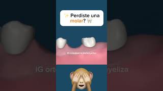 Molar uprighting orthodontictips ортодонтия kieferorthopädie विषमदंत ortodonzia orthodontie [upl. by Poppas731]