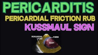 Pericarditis  Pericardial Friction Rub and Kussmaul Sign  EXPLAINED [upl. by Tamma]