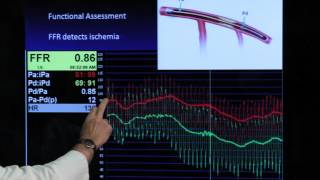 FFR Basics Practice Pitfalls  Mort Kern [upl. by Bertrando63]